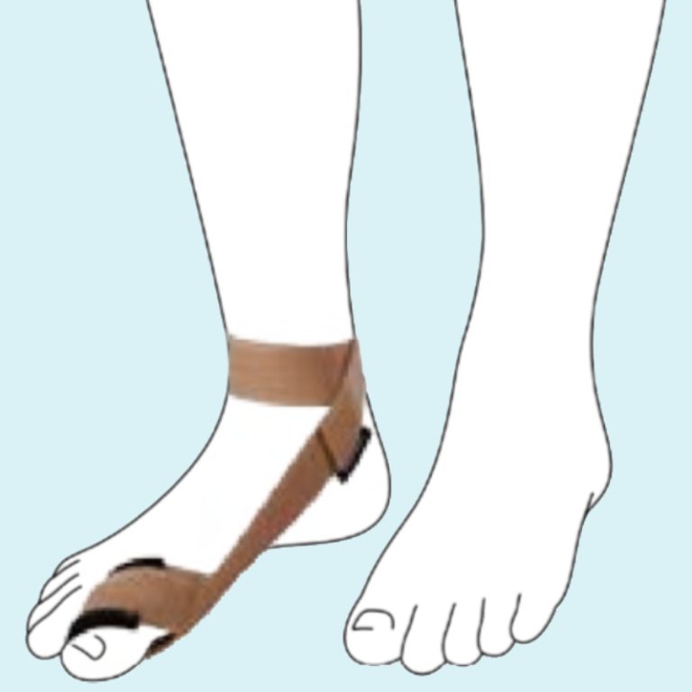 Ottobock Hallux Valgus Combo Comfort